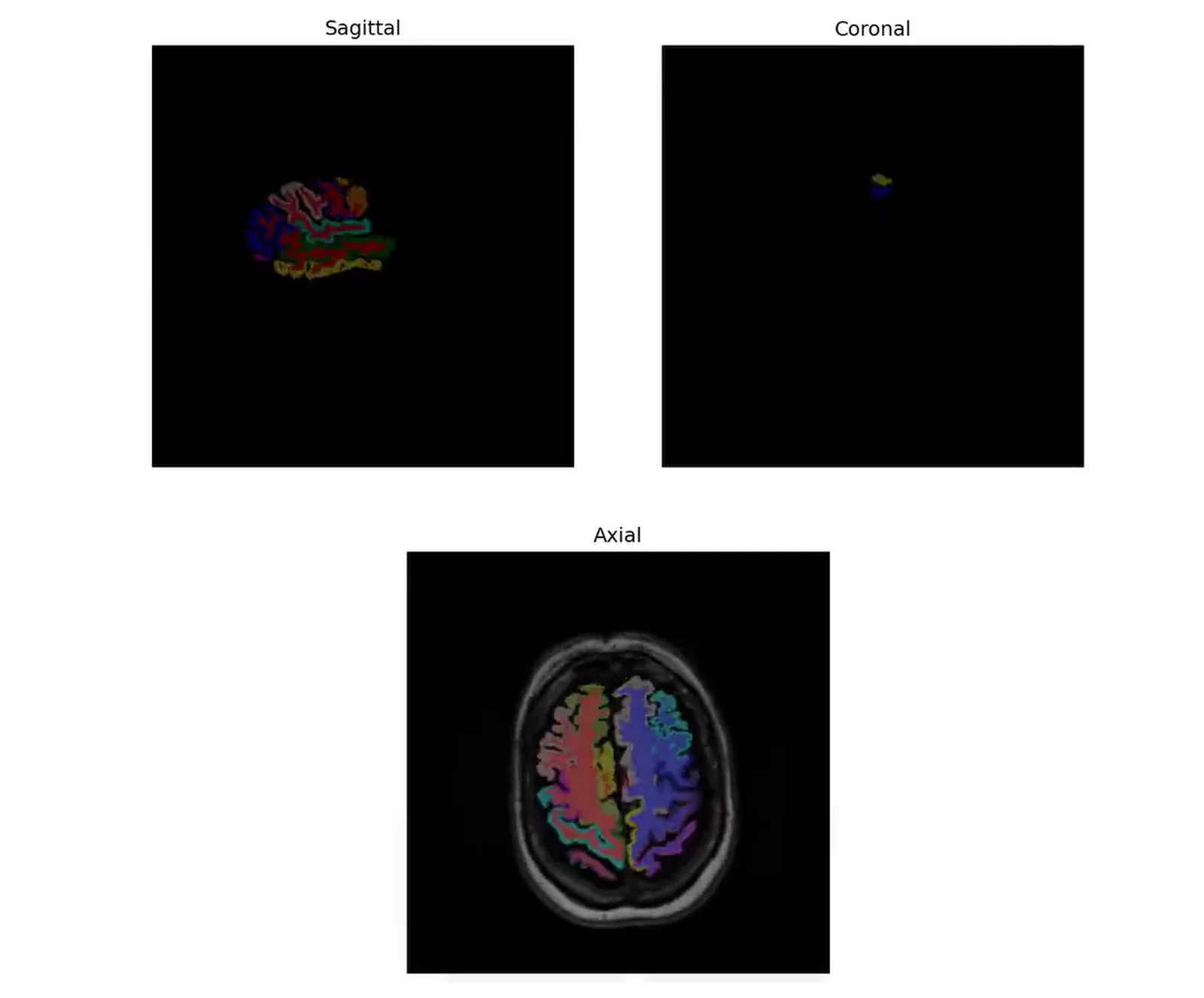 Brain MRI Segmentation, screen 2